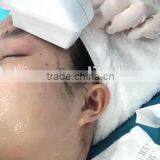 Back Tightening Hot New Products For 2015 Hifu Ultrasound Therapy Machine Face Lift Eyes Wrinkle Removal thumbnail-4