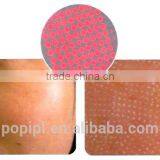 Laser Resurfacing thumbnail-3