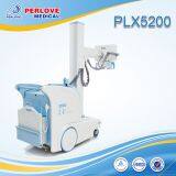 Digital X-ray Portable Radiography System PLX5200 thumbnail-1