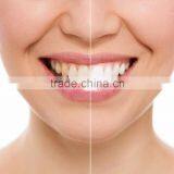 Teeth Whitening Spa Starter Package thumbnail-5