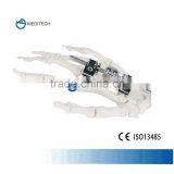 Orthofix Mini External Fixation Orthopedic Surgical Instruments