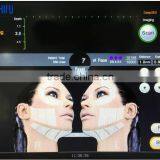 Hips Shaping Professional Hifu Ultrasonic 8MHz Face Lift Machine thumbnail-4