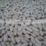 SPECKLED KIDNEY BEANS thumbnail-5