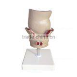 Rectum Pathology Organs Education Human Body Anatomy Model thumbnail-2