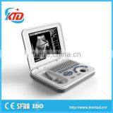 modern design mobile ultrasound machine with low price