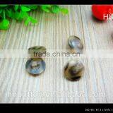 Oeko-tex Approved Custom Sewing Button Supplier