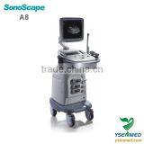 Hot Sell Medical 2d Trolley B/w Ultrasound Sonoscape a8