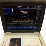 Популярный портативный цветной допплеровский ультразвуковой сканер медицинское оборудование для больниц thumbnail-3