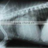 Medical Thermal x Ray Film,medical Thermal Dry Film ,medical Surgical Consumables thumbnail-1