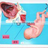 Training Model of Fetal Production Process in the Model of Term Fetus thumbnail-4