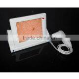 AYJ-J015 High Quality Facial Analyzer Machine thumbnail-6