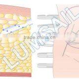 LUMSAIL Vaser Tumescent Liposuction Machine BS-LIPS5 thumbnail-5