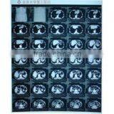 Good Quality Konida Automatic Medical X-ray Fuji Dry Film Agfa Holder Processor thumbnail-2