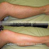 OEM Depilation Machine/808 Diode Laser Hair Removal thumbnail-5