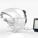 2020 Trending Products 3d Skin Analyzer on Promotion 3D Skin Analysis Smart Moji Digital AI Skin Analysis thumbnail-4