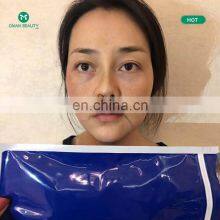 Cheap Surgical 3d Suture Medical Face Lifting Pdo Pcl Needle Fine Thread Lift and Weaving Needles thumbnail-4