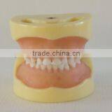 Pediatrics Typodont Teeth Model (20 Teeth) With Removable Screw Teeth thumbnail-1