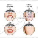 New Original Tattoo Removal Machine 3 in 1 thumbnail-5