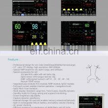 Multi-parameters Portable Veterinary Vet Vital Sign Monitor thumbnail-3