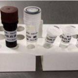 2019-Novel Coronavirus (2019-nCoV) RT-PCR Detection Kit Covid 19 Rapid Test Kit Wholesaler/distributor thumbnail-2