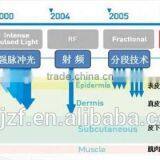 Anybeauty Portable With Medical CE ISO Portable Hifu Ultrasound 7 Heads thumbnail-4