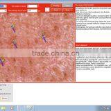 Multi-function New 3D Portable Skin Analyzer for Skin Care thumbnail-5