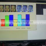 Big Discount!!!3d Scanner Dialysis Machine Price Dialysis Machine Price for Home Use thumbnail-5