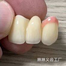 Produktion Deutsche Zahnprothesenbearbeitung thumbnail-3