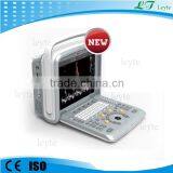 LTE9 Portable Color Doppler Cardiac Vascular Ultrasound Equipment