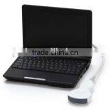 Portable Laptop Ultrasound Scanner With CE thumbnail-3
