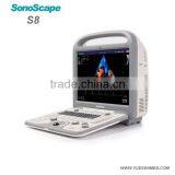 Veterinary Hospital Scanner Ultrassom Sonoscape a5 Vet thumbnail-4