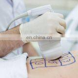 Vacuum Cavitation System Liposonic Hifu Body Slimming Machine thumbnail-6