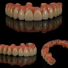 Clear Aligner Lab From China Orthodontics Lab From China thumbnail-3