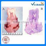 Microscope Accessories Biological Oral Pathology Prepared Slides