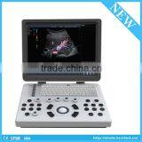 KONTED C6 USG Full Digital 4D Laptop Ultrasound Machine Price Portable 4D Ultrasound Machine