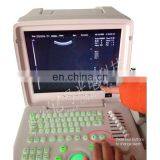 DW360 Portable Full -Digital Ultrasound Scanner thumbnail-2