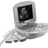 Medical Laptop B Mode Ultrasound Scanner RUS-2200 USB 2.0 Optional Biopsy Brackets thumbnail-1