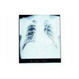 Low Fog Dry Medical Imaging Film KND-A / KND-F For Thermal Printers thumbnail-1