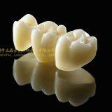 Dental Crown 3M Lava Zirconia, Dental Teeth, Dental Prosthesis, Laboratoire Dentaire, Dentallabor, Laboratorio Dental, Dental Laboratory, Shenzhen LJ Dental Lab China thumbnail-5
