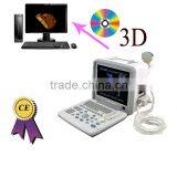 Factory Price!CE Approved Notebook B-Mode Ultrasound Scanner With 7.5Mhz Multi-frequency Linear Probe RUS-9000B thumbnail-1