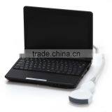 CE FDA Mark 10 Inch Laptop Veterinary / Vet Ultrasound Scanner With 3.5MHz Convex Probe Rectal With USB Port thumbnail-2