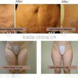 Face Lifting Body Shaping Machine Cavitation+IPL+RF+Vacuum No Pain Reduce Belly Fat Naturally Device Shrink Trichopore thumbnail-6