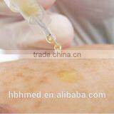 Non-pyrogenic Platelet Rich Plasma Prp Kit Easy thumbnail-3