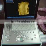 Sonostar Hospital Veterinary Equipment B Model Ultrasound Machine for Sale V9 thumbnail-4