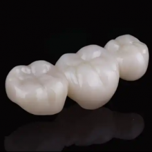 CAD-CAM Digital Milling Fixed Dental Laboratory FMZ Crowns & Bridges Restorations LAVA Zirconia thumbnail-2