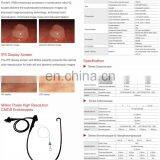 MY-P053 Endoscopic Camera Manually Adjust Brightness Medical Electronic Gastroscope Colonoscope Endoscopy System thumbnail-5