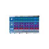 Intel E5200 Cpu 100% Original Cpu thumbnail-2