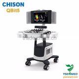 Chison Hot Selling Portable 4d Color Doppler Ultrasound Chison Qbit 5