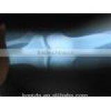 Agfa X-ray Film 14x17 Blue Medical Film 8x10in Made in Chinafilm for Hospital Agfa X-ray Film thumbnail-2