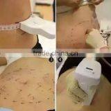 Professional High Frequency Machine Liposonix Hifu Machine Hips Shaping / Hifu Slimming Machine High Frequency Facial Device thumbnail-6